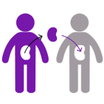 kidney_transp kidney_transp